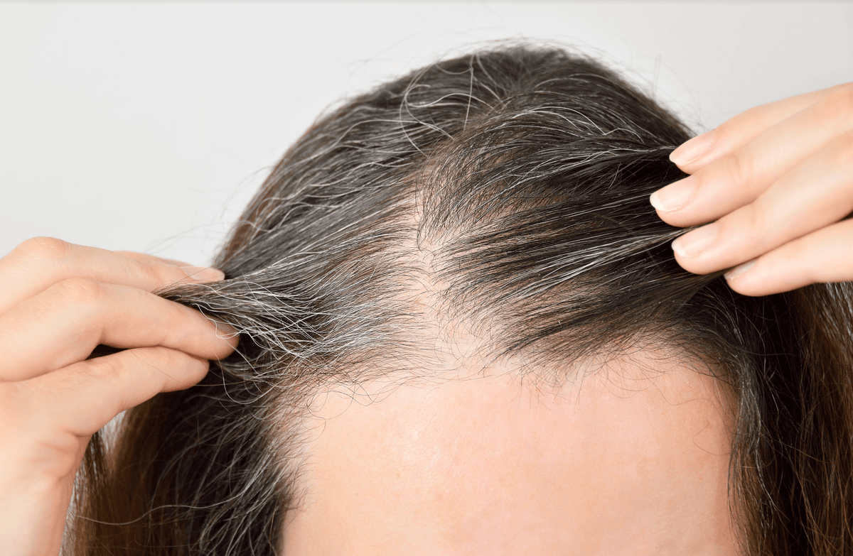 Losing Your Hair? Causes of Hair Loss and How To Treat It